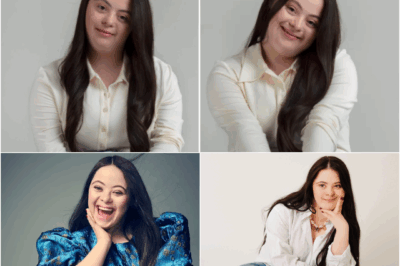 Never Give Up: Ellie Goldstein’s Powerful Message on Life, Dreams, and Being Yourself