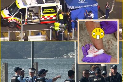 “THIS SHOULD NEVER HAVE HAPPENED TO A CHILD”: 13-Year-Old Left Critically Injured in Sydney Harbour Shark Attack — Police Share Chi:lling Details About Both Legs, Raising Fears of the Unthinkable