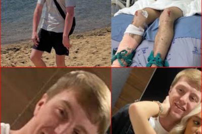 “DREAM HOLIDAY TURNS INTO A FIGHT FOR L!FE…” — Brit battl!ng for survival after horror scooter crash in Thailand