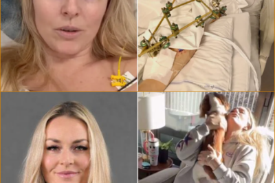 HEART-WRENCHING: Lindsey Vonn Shares 6 Words That Leave Fans Speechless Amid Injury Recovery