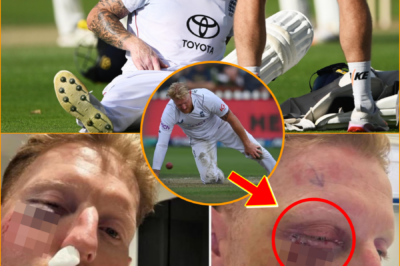 I MIGHT NOT BE HERE… — Ben Stokes breaks silence on freak cricket accident, reveals terri-fying moment he thought it could all end differently