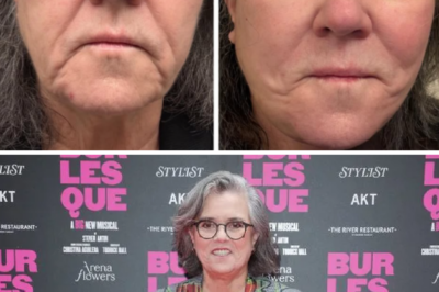 “I wouldn’t be able to respect you if you did it”: Rosie O’Donnell speaks out for the first time, sharing her deep hesitations before undergoing a major, life-changing plastic surgery